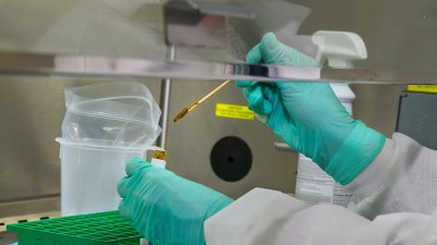 След разрешаването на десетилетна загадка: Учени дават надежда за нов метод за лечение на рак на дебелото черво
