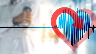 Сърцебиене, задух, усещане за „прескачане“: Как да разпознаем и лекуваме аритмията 