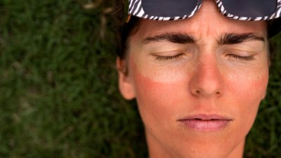 Туристически неволи: Да забравите слънцезащитния крем и да се превърнете в омар