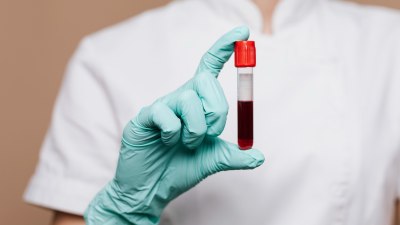 Хемофилията &ndash; наследствена, коварна и животозастрашаваща 